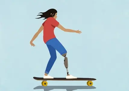 Girl with prosthetic leg skateboarding against blue background