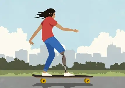 Girl with prosthetic leg skateboarding on sidewalk